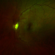 Illustration for article titled Why You Should Thank an Astronomer for Preventing Blindness
